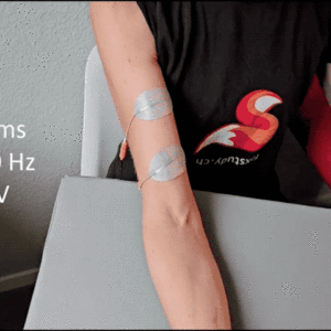 Comprendre et utiliser l'électrostimulation moderne